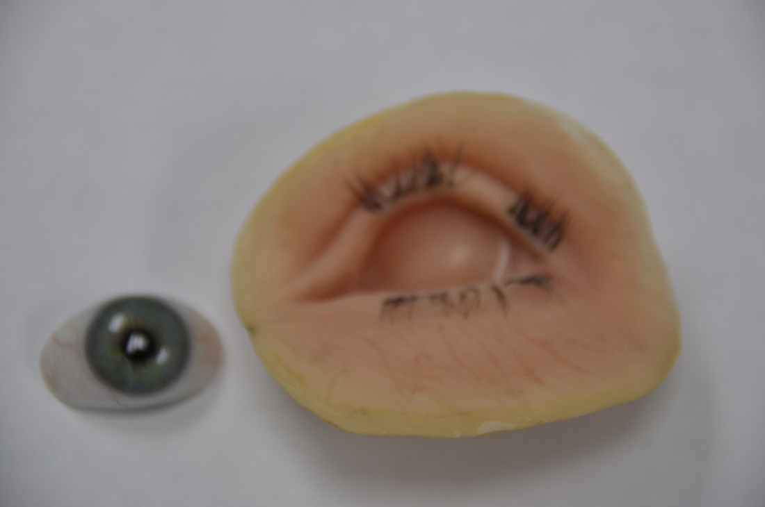 Photo of a sample of a facial prosthesis with a green eye removed