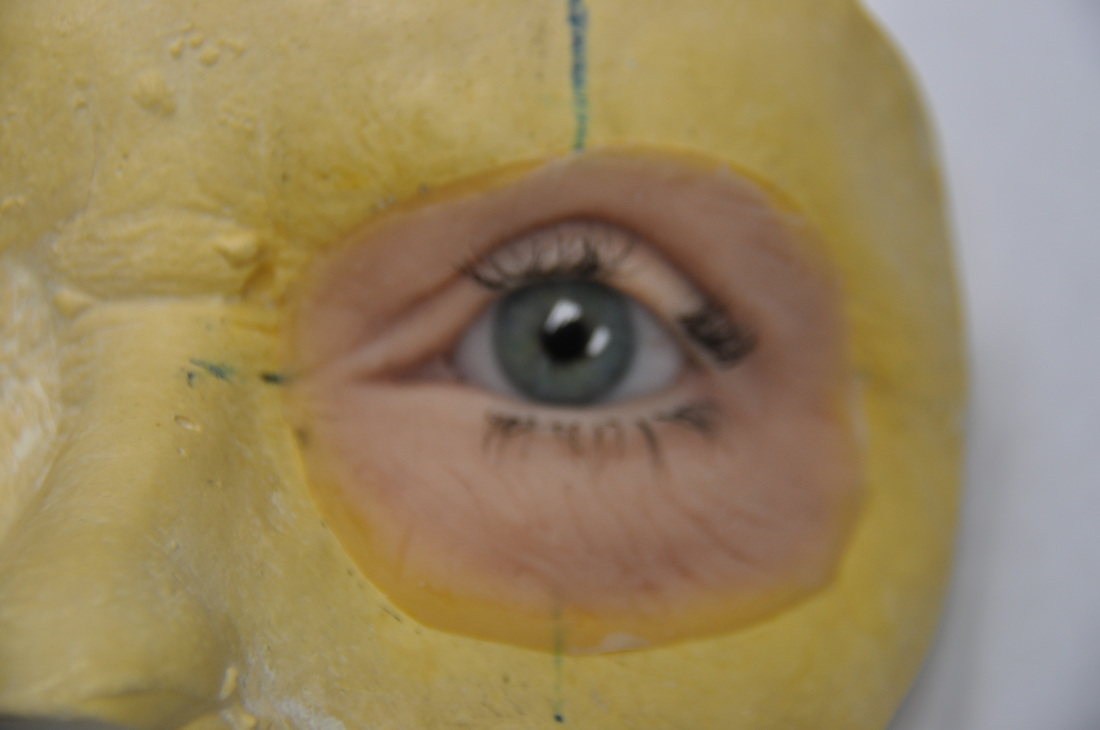 Up close photo of a sample of a facial prosthesis with a green eye sitting on a mold